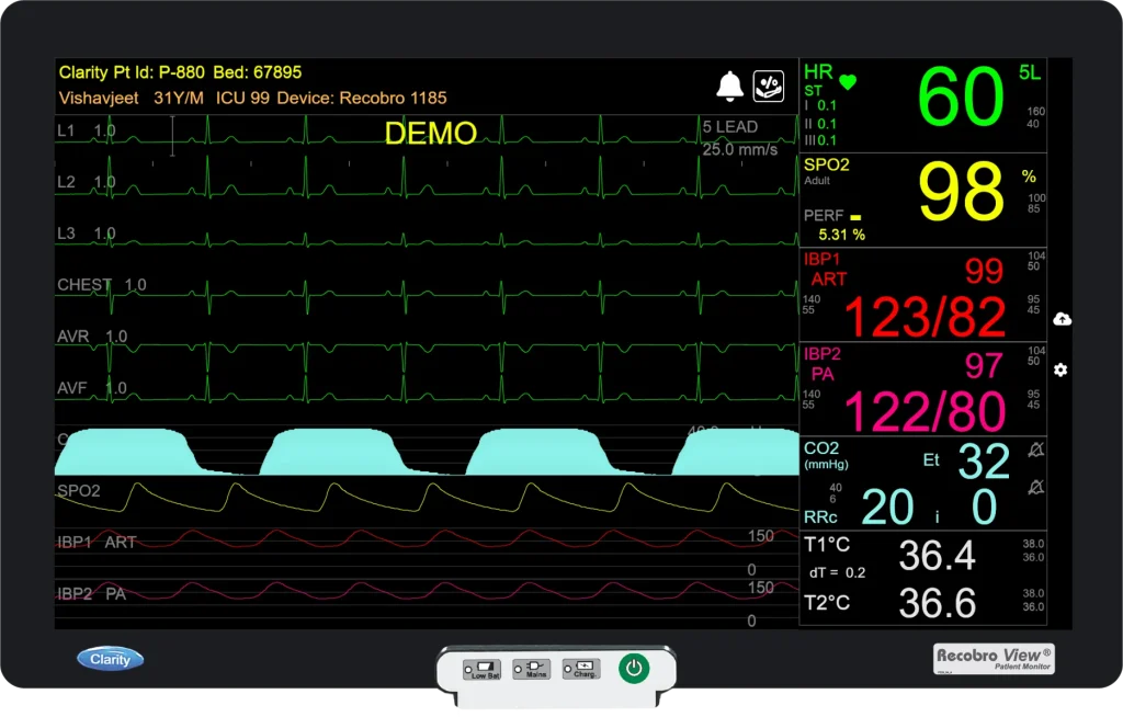 Cardiac Patient Monitors by PVMEDIPOINT